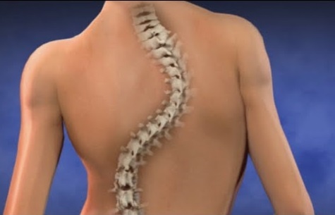 Chang trai cong cot song mo uoc duoc ngoi xe lan hinh anh