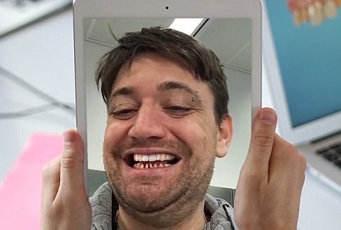 'Guong ao' giup ban nhin thay ham rang moi truoc khi chinh sua hinh anh