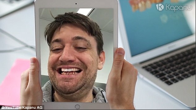 cong nghe chinh rang 3D anh 1