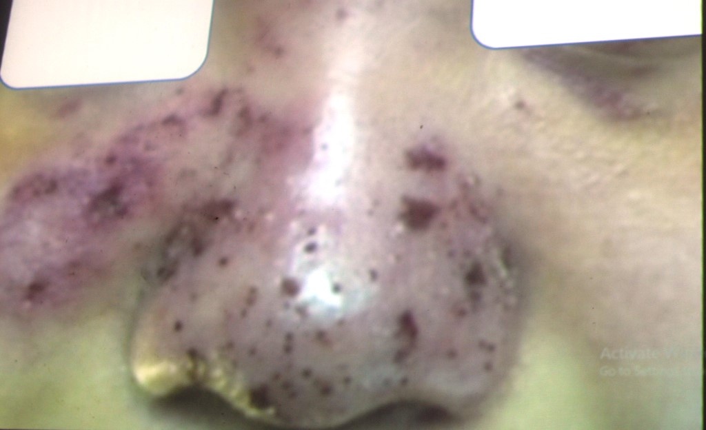 huy hoai nhan sac anh 1