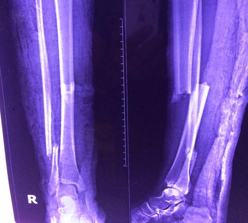 Bac si tuyen tren tu choi benh vien quan van mo thanh cong hinh anh