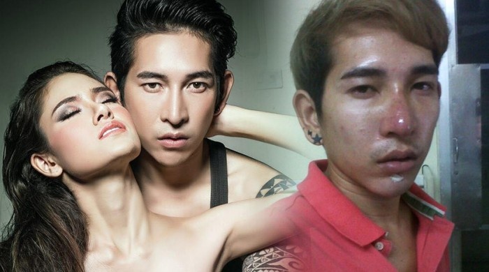 Bi ban gai bo roi vi xau, chang trai lot xac nho dao keo hinh anh