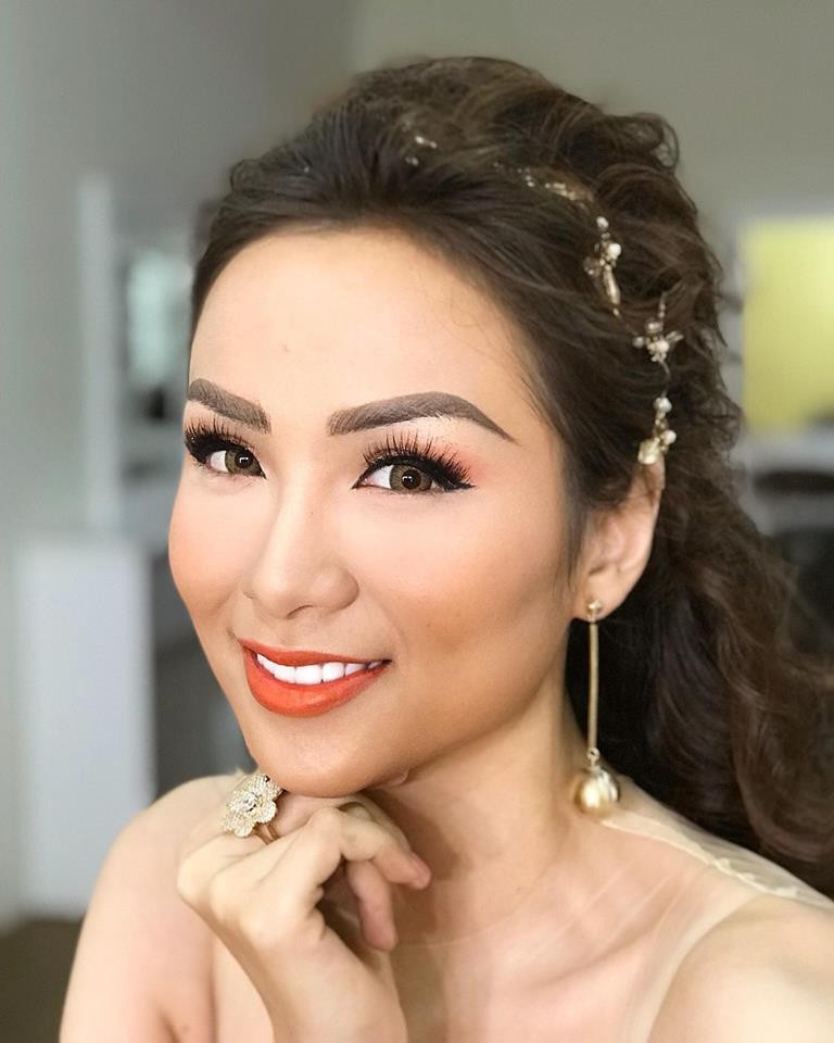 Diem Huong phau thuat tham my anh 3