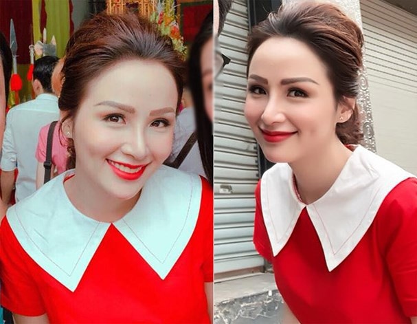 Diem Huong phau thuat tham my anh 1