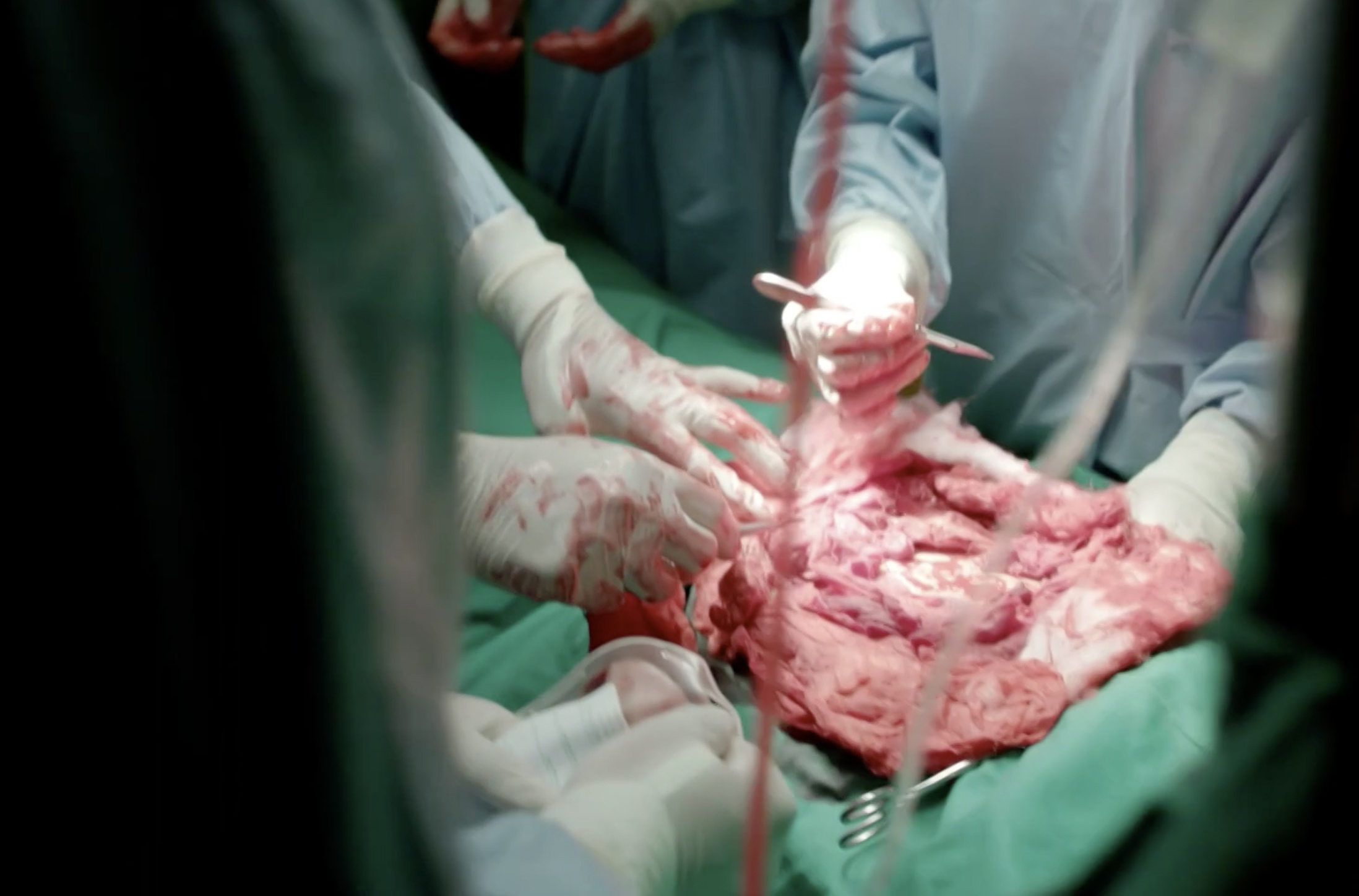 nhat san hau due mat troi anh 6