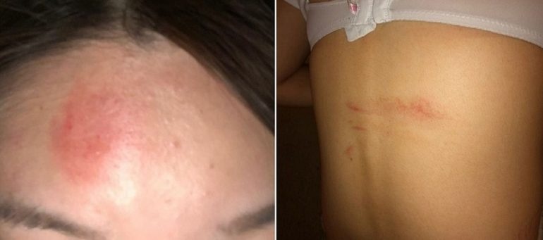 sinh viên bị hành hung trên xe buýt ảnh 1 sinh vien bi hanh hung tren xe buyt anh 1