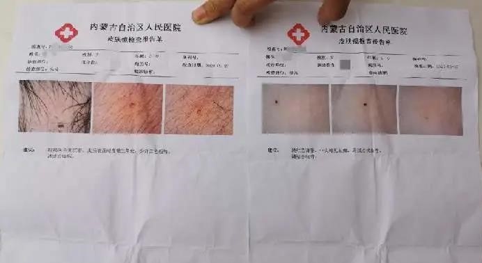 Giao vien Trung Quoc bi tam giam vi dam kim vao nguoi hoc sinh hinh anh