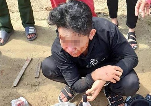 Hoc sinh o Quang Binh bi danh bat tinh hinh anh