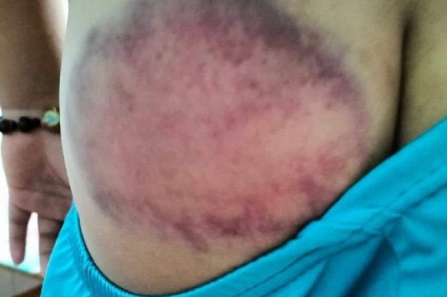 Thoi bong bong trong gio hoc, nam sinh lop 4 bi thay danh tim mong hinh anh