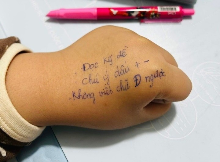 'Phao thi' tren tay be lop 2 gay thich thu hinh anh