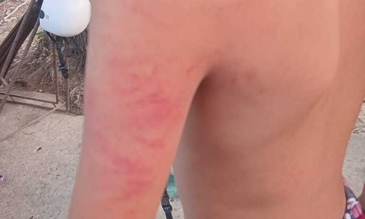 Con lop 1 bi danh bam tim co the, me den truong tat co chu nhiem hinh anh