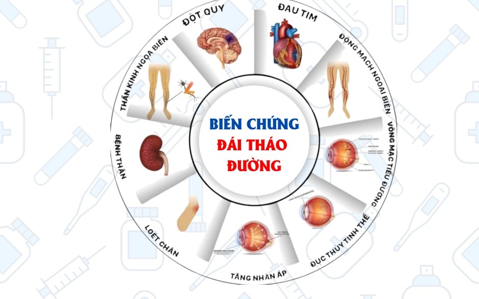 benh nhan tieu duong anh 2