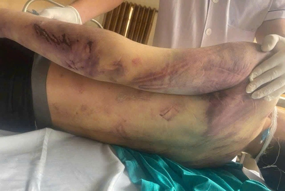 hoc vien tu vong anh 1