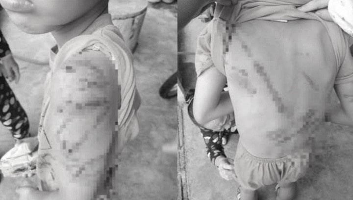 Hoc sinh lop 4 o Dak Lak bi cha danh bam tim co the hinh anh