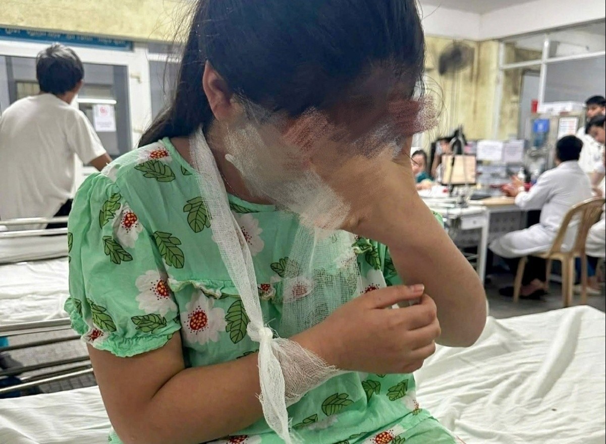 Hoc sinh lop 4 bi co giao danh phai vao benh vien hinh anh