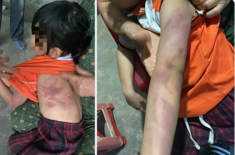 Be gai lop 2 bi ban dung thuoc danh bam tim nguoi trong gio ra choi hinh anh