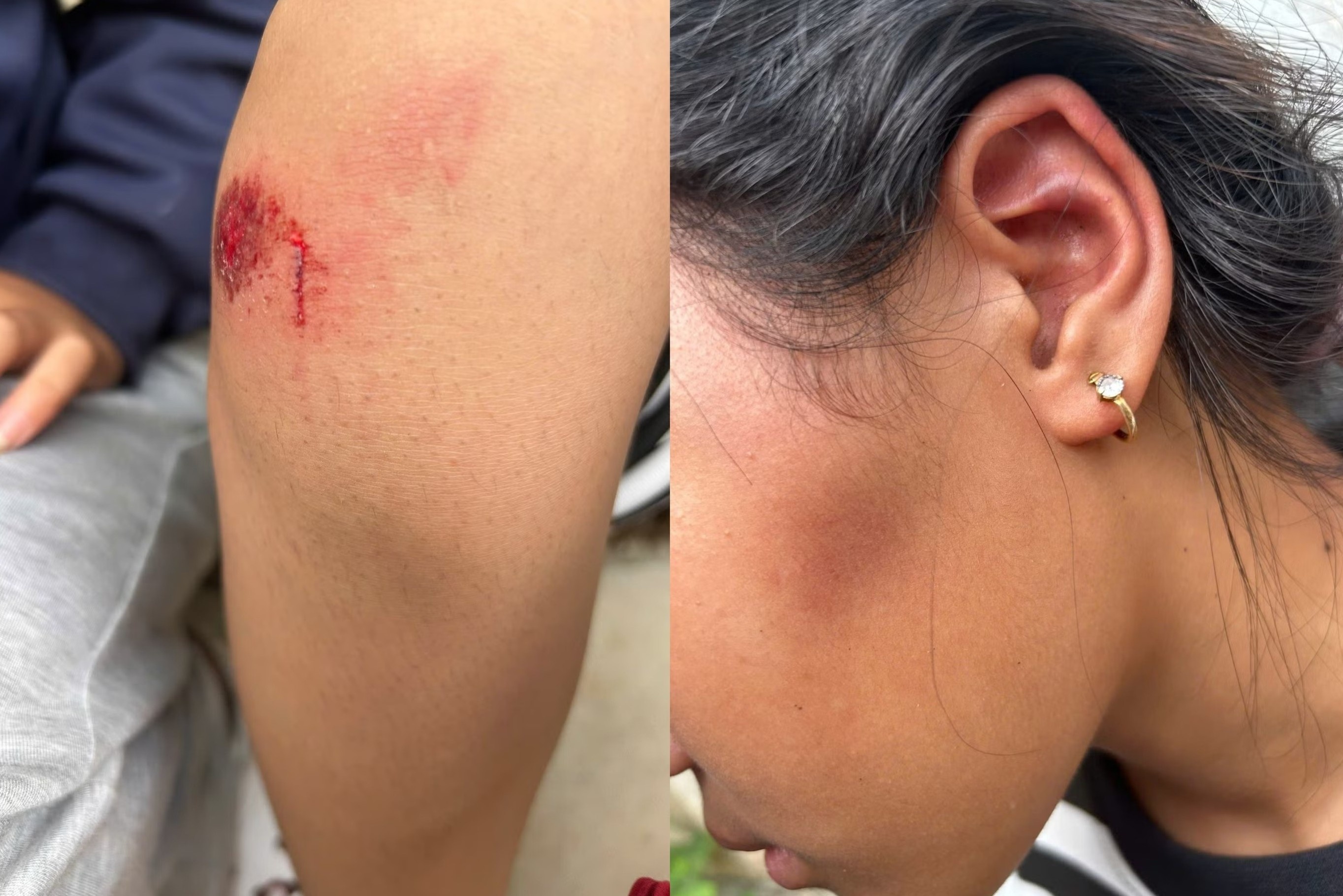 Nu sinh lop 6 bi danh hoi dong, bat quy duoi nang, lau chan hinh anh