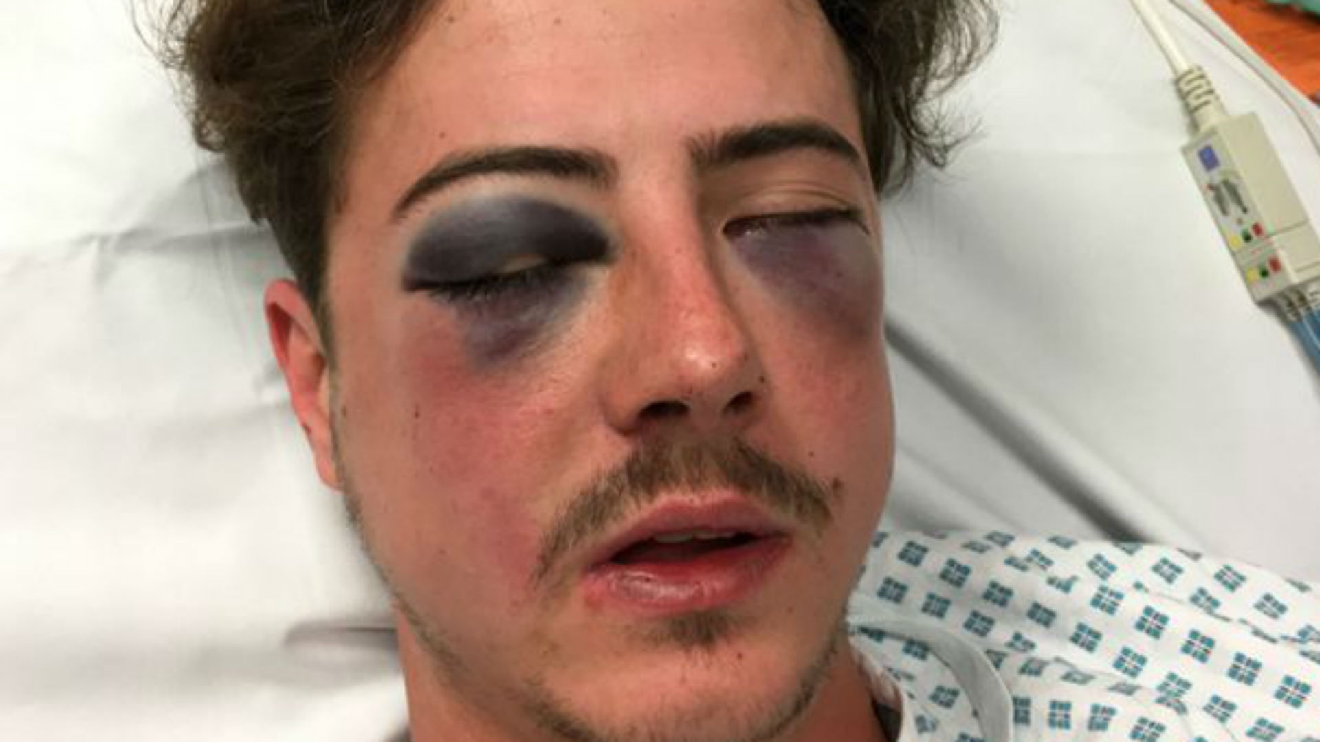 bị đánh vì nhầm là fan chelsea ảnh 1 bi danh vi nham la fan chelsea anh 1