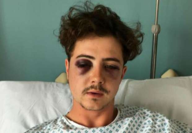 Chang trai bi fan Tottenham danh vo so vi tuong la CDV Chelsea hinh anh