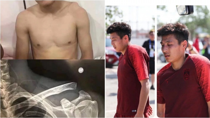 Wu Lei chấn thương,  lỡ trận gặp Thái Lan ảnh 1 Wu Lei chan thuong,  lo tran gap Thai Lan anh 1