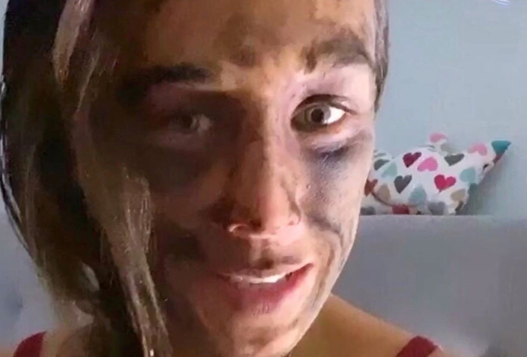 Guong mat bam tim cua nu vo si sau tran tranh dai vo dich UFC hinh anh