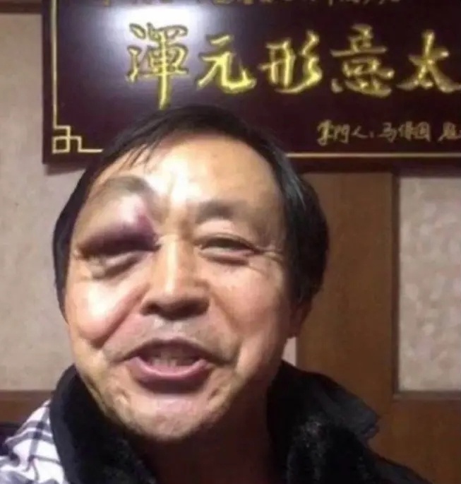 Nhat Long hen nhat anh 1