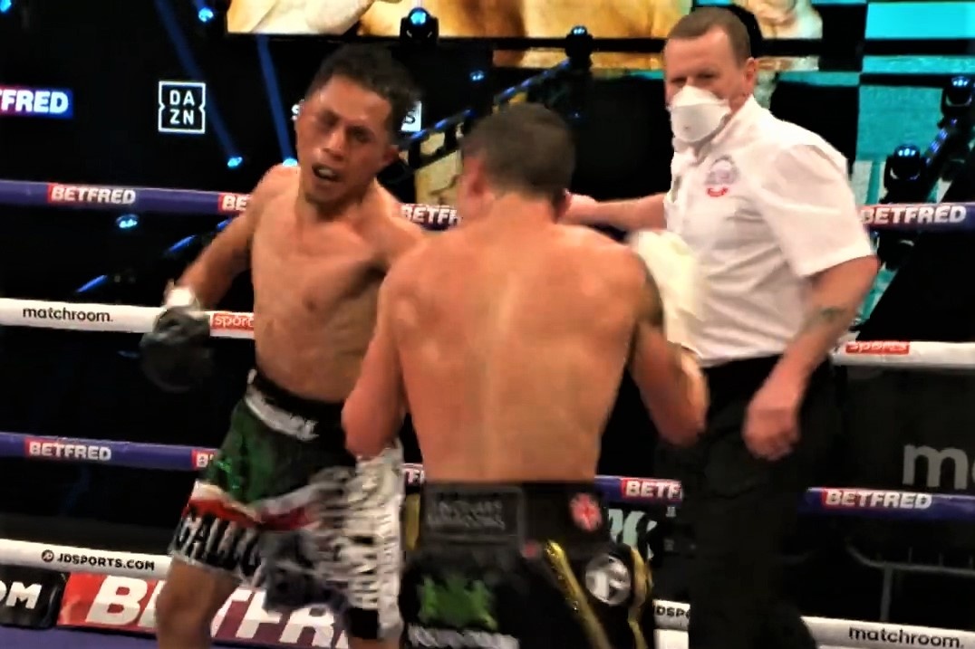 Cu knock-out khien cuu vo dich the gioi gay xuong ham hinh anh