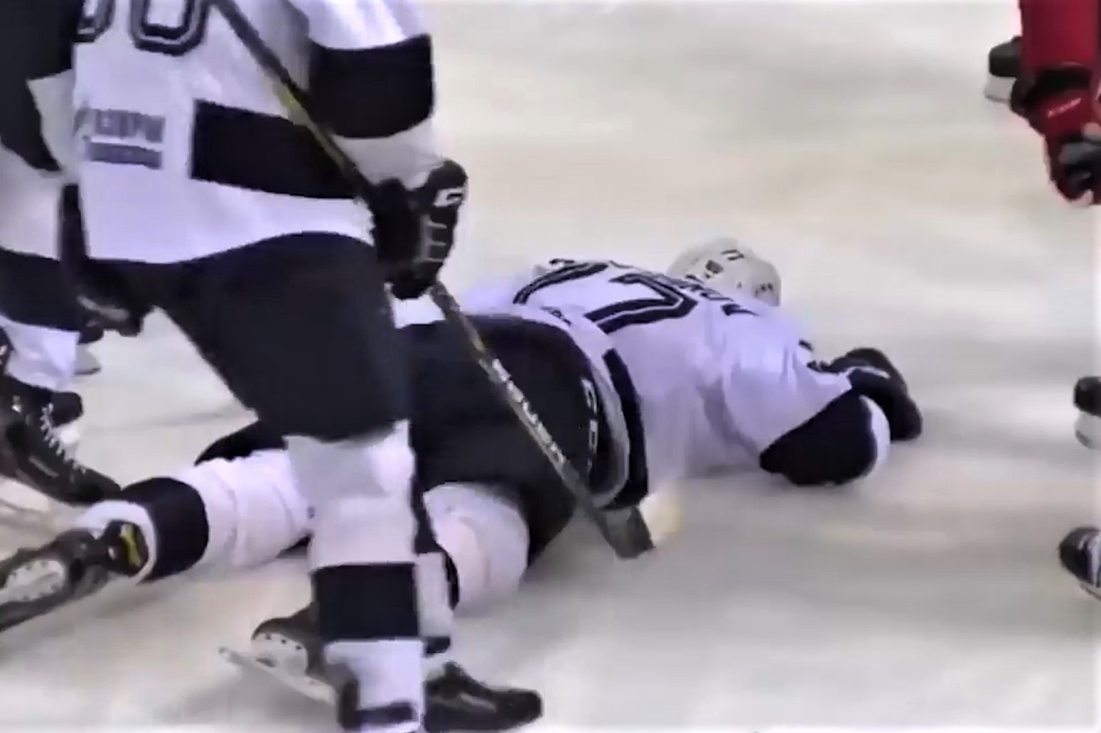 Cau thu 19 tuoi thiet mang sau khi bi bong dap vao dau hinh anh