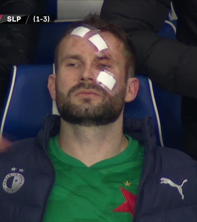 cú đá trúng mặt thủ môn ảnh 2 cu da trung mat thu mon anh 2