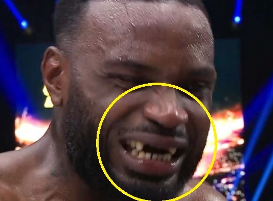 Vo si nuot luon rang sau cu dam cua doi thu hinh anh