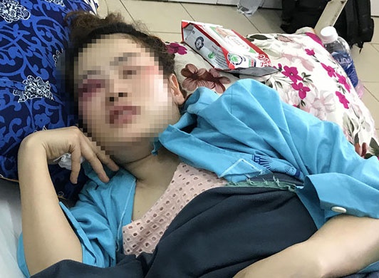 Nam 9X danh co gai tai quan banh xeo la chau truong cong an phuong hinh anh