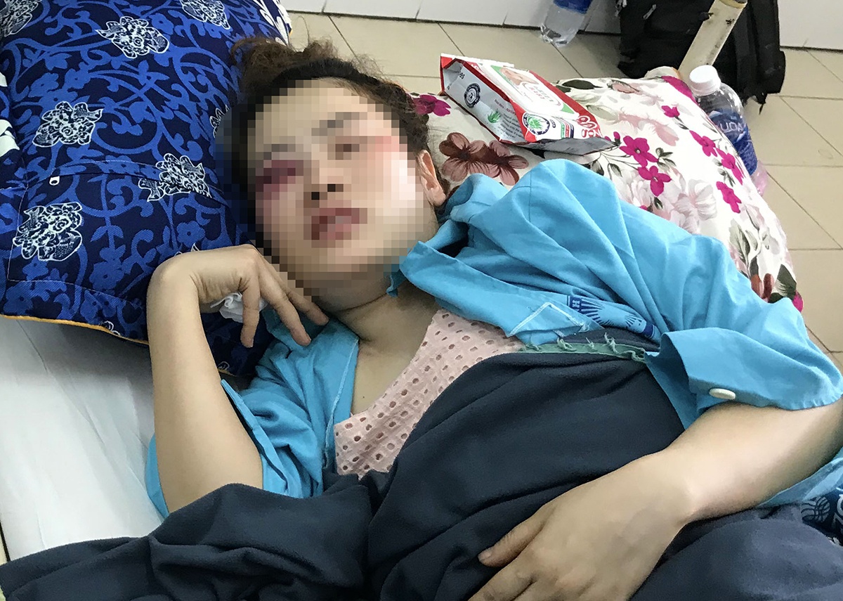 Den sau nhung lay thuc an truoc, co gai bi danh nhap vien hinh anh