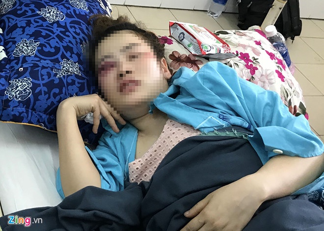 Nam thanh nien danh co gai tai quan banh xeo o da nang anh 1