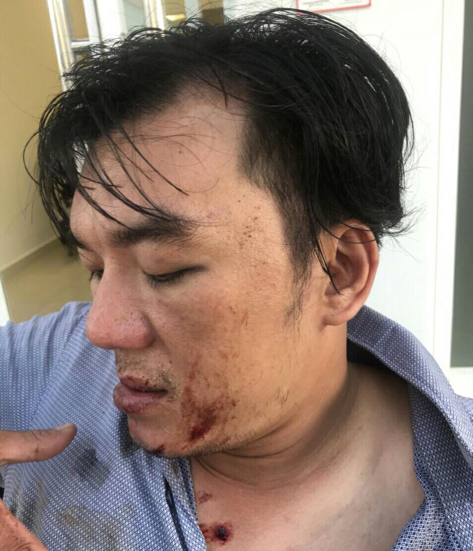 Du khach to bi nhan vien nha hang danh nhap vien sau bua an o Da Nang hinh anh