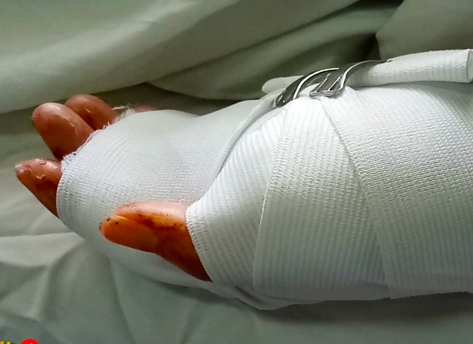 Nguoi phu nu bi chem trong tiem game ban ca hinh anh