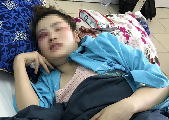 Nam thanh nien danh co gai tai quan banh xeo bi phat 1,5 trieu hinh anh