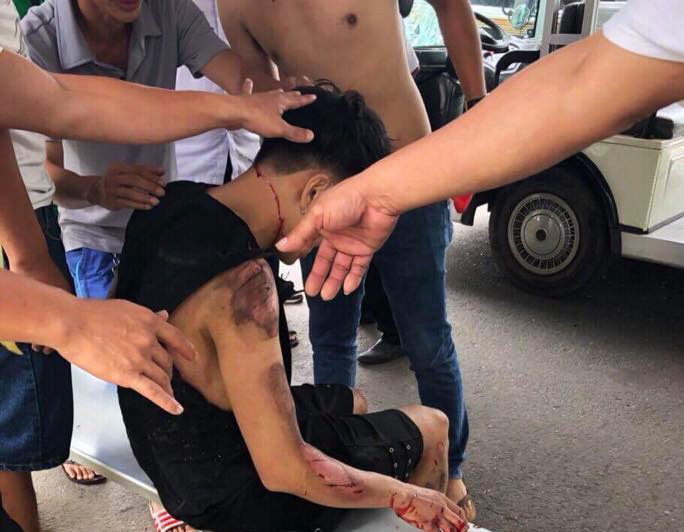 Xe điện tông du khách ảnh 1 Xe dien tong du khach anh 1