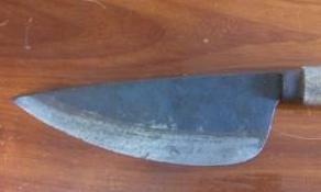 Cuu song nu benh nhan bi dao dam xuyen co hinh anh