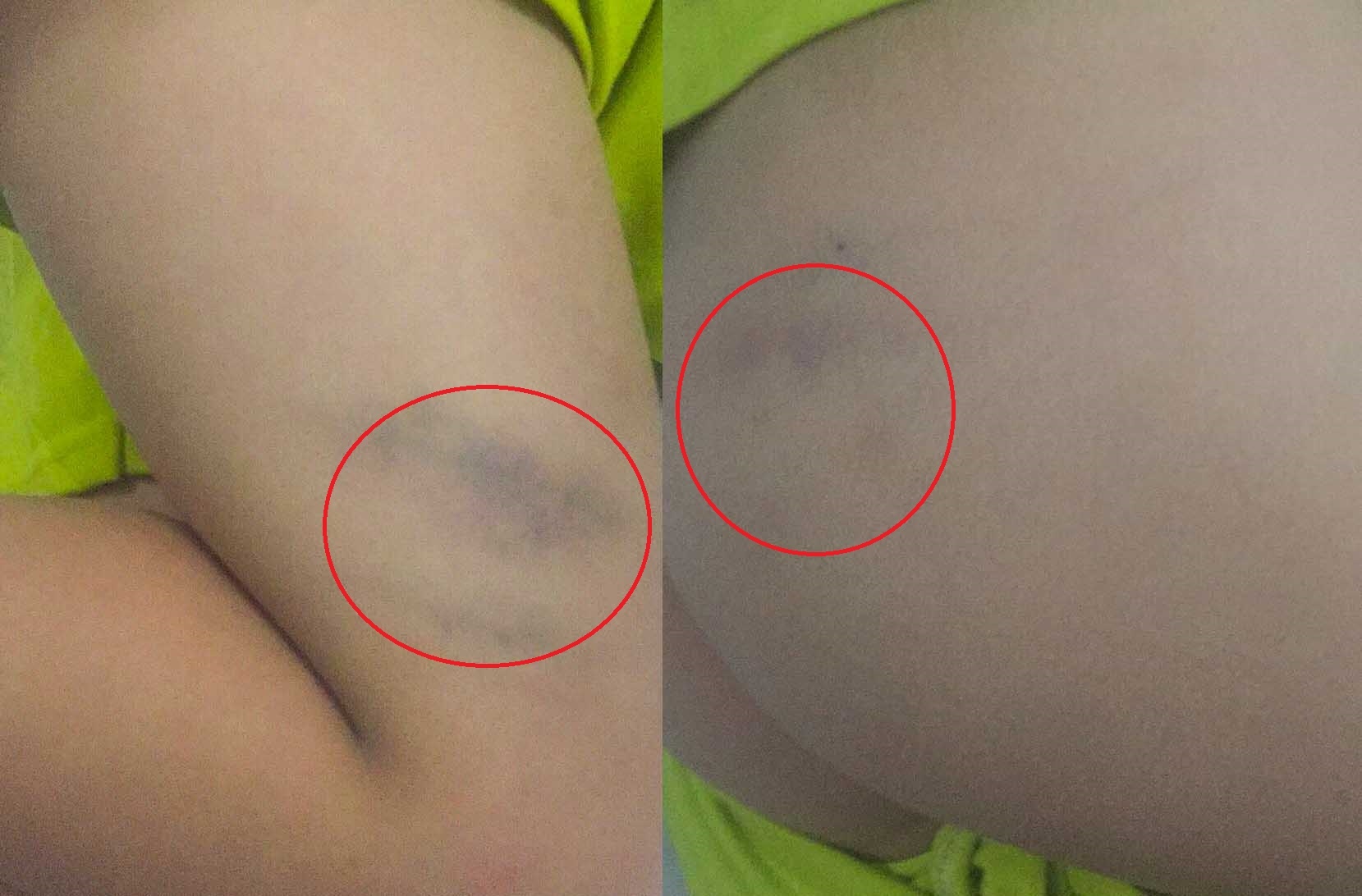 Phụ huynh tố giáo viên đánh con ở đà nẵng ảnh 2 Phu huynh to giao vien danh con o da nang anh 2