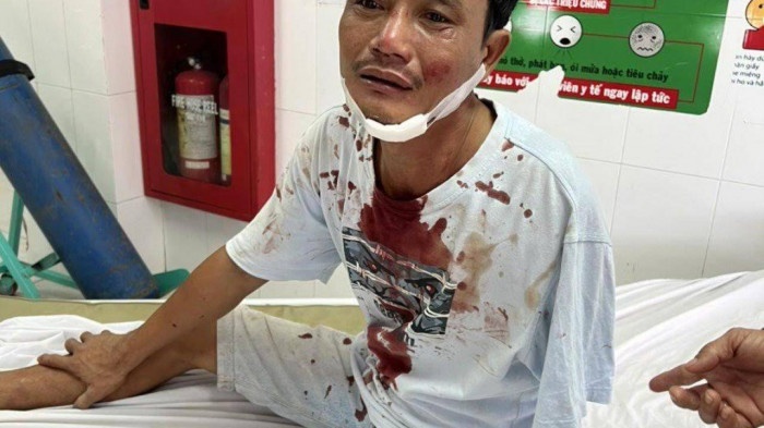 Nguoi tan tat bi vo chong tai xe xe tai danh nhap vien hinh anh