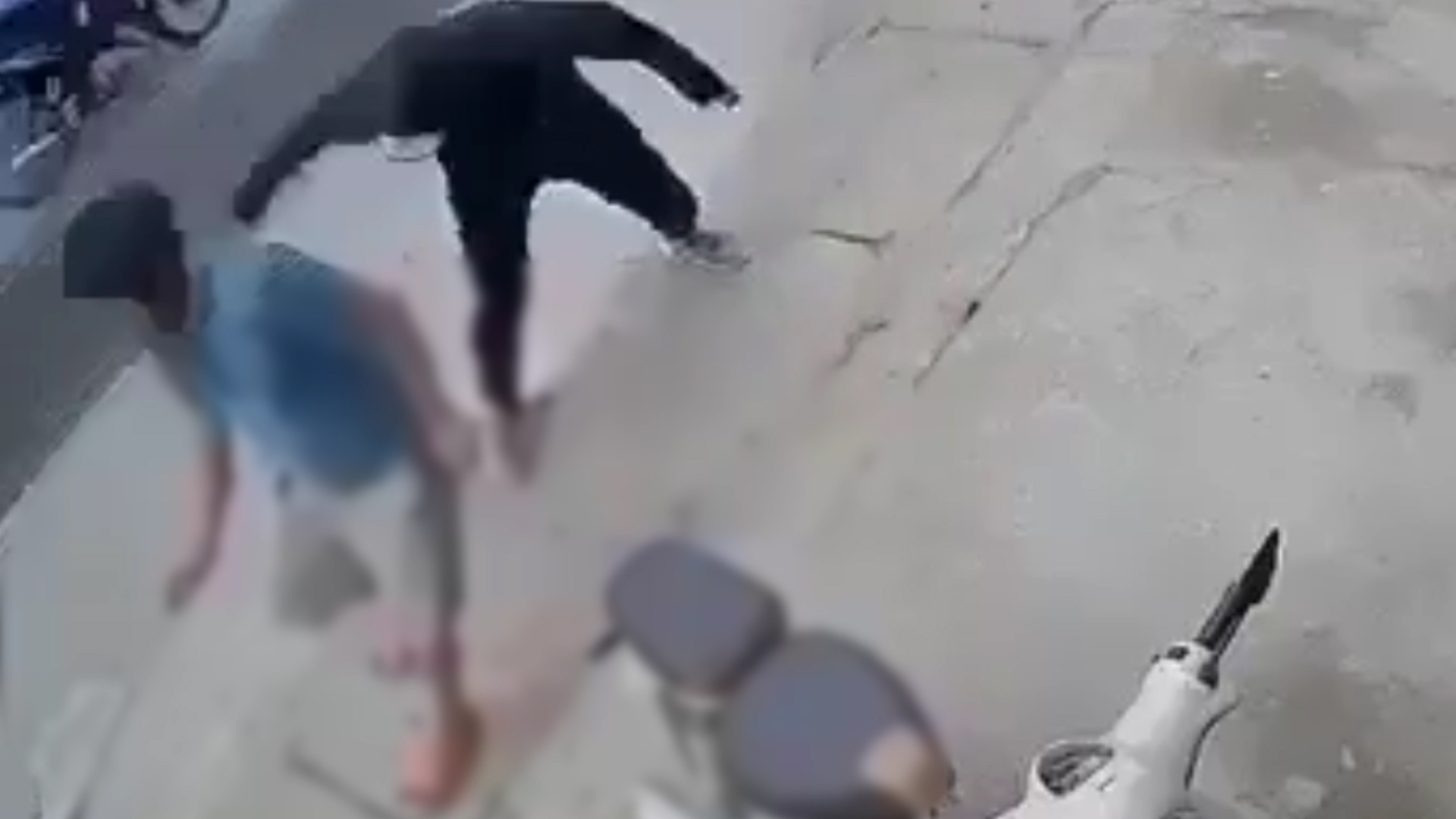 Nguoi dan ong bi chem dut lia chan hinh anh