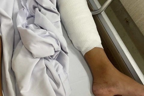 Nhom thanh nien mang hung khi vao quan nhau truy sat nguoi hinh anh