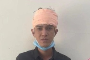 Thanh nien dam chet tinh dich vi ghen tuong da ra dau thu hinh anh