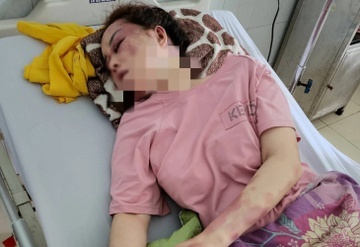 Tran danh ghen keo dai 3 gio qua loi ke nan nhan hinh anh
