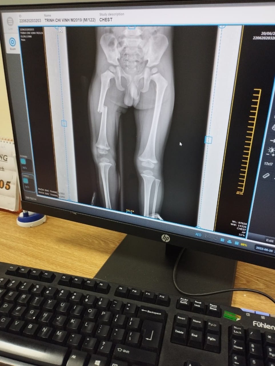 me dap gay dui con anh 1