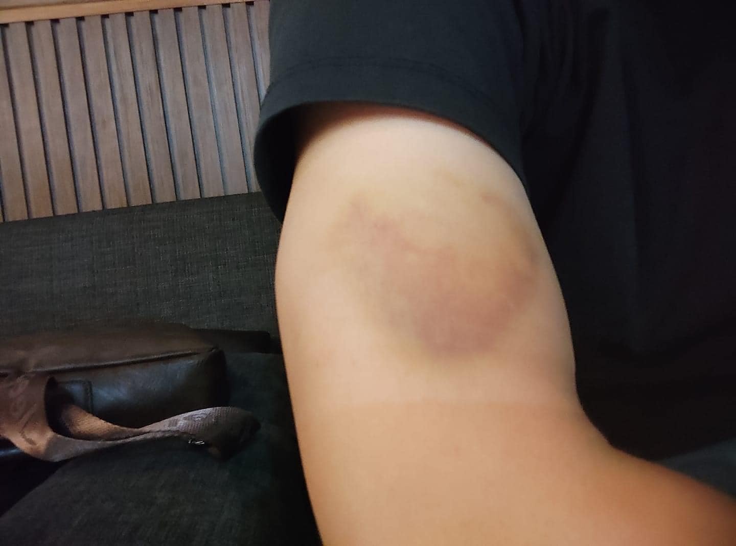 tan cong nguoi di duong anh 2