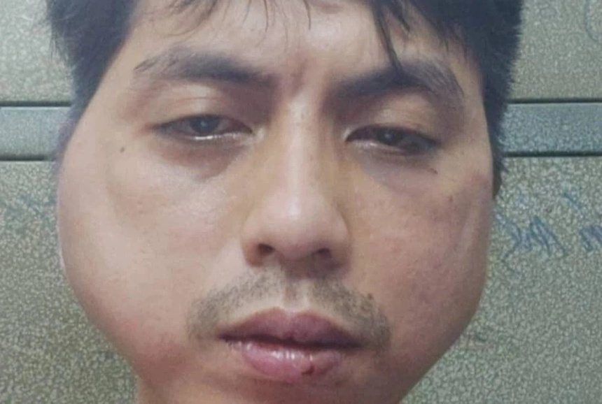 Khoi to vu nhan vien bi chu quan lau danh bien dang mat hinh anh