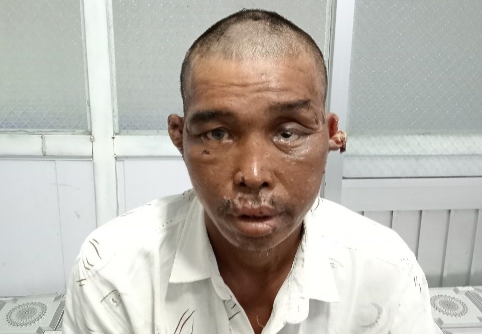 Vu nguoi dan ong bi hanh ha: Them toi co y gay thuong tich hay khong hinh anh