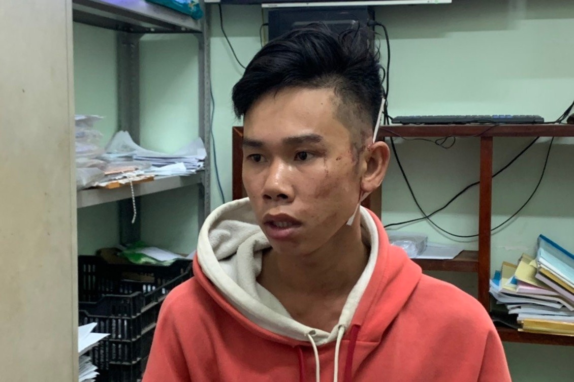 An mang tu mau thuan hat karaoke hinh anh