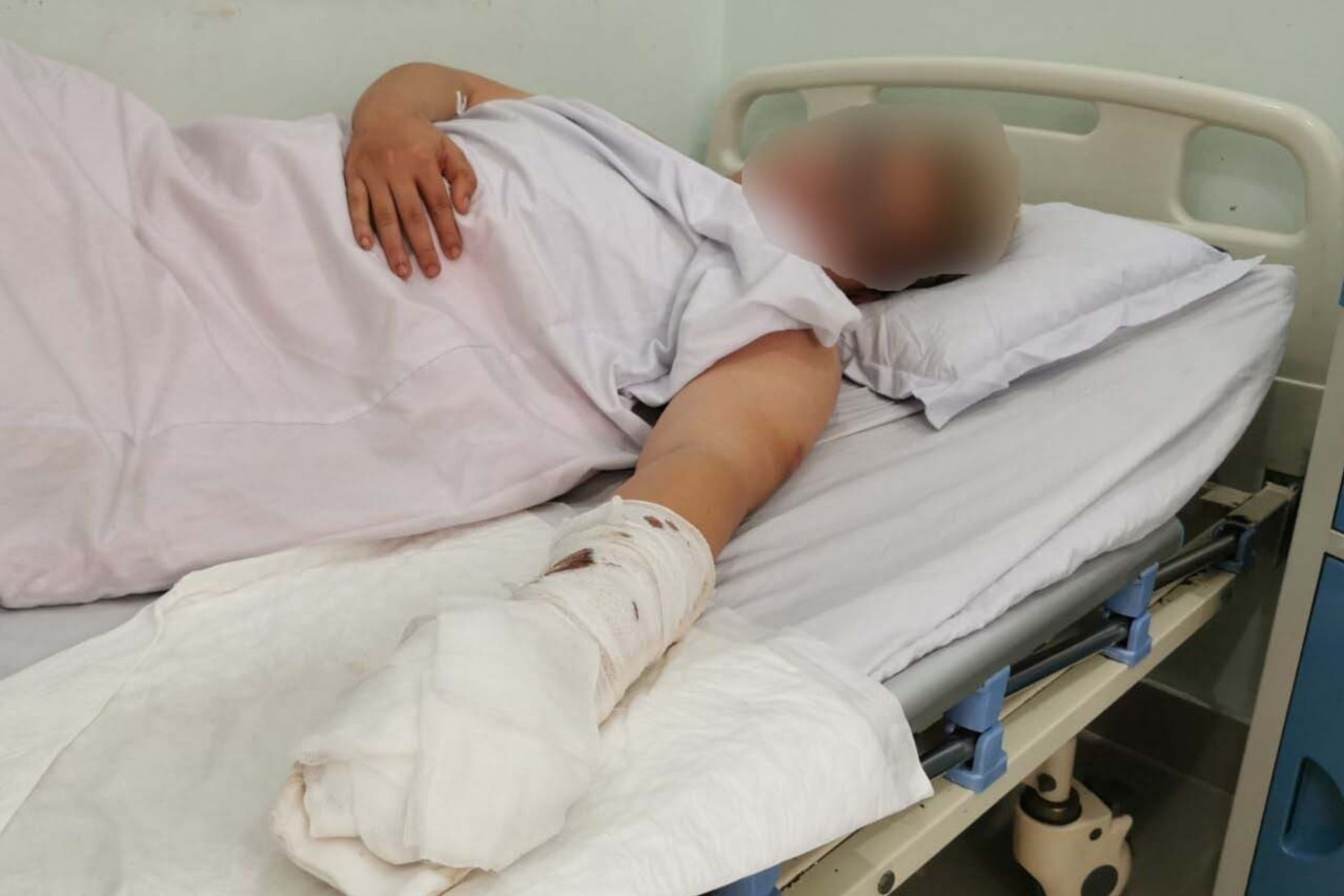 Bi chem dut lia ngon tay khi dang da bong hinh anh